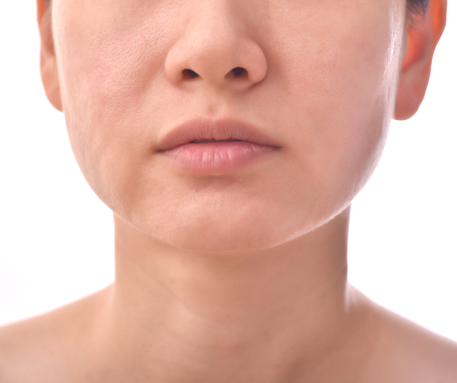 Zo snapt Google dat het om een voor/na resultaat gaat en koppel je het direct aan je productnaam.